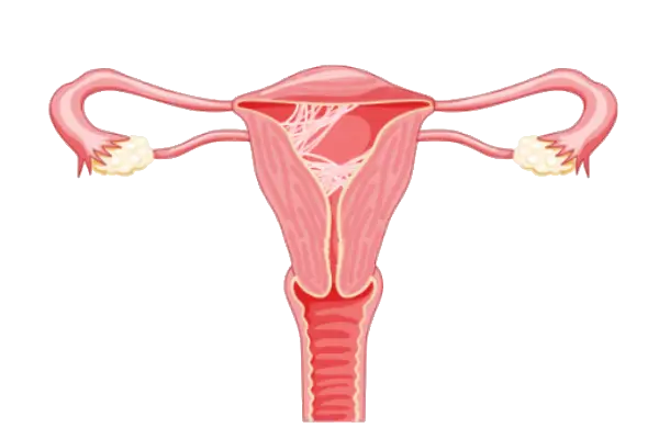 Dr. Rafael Alves - Tratamento de Sinéquias em Recife, Caruaru e Palmares